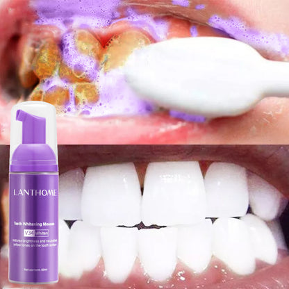 Teeth Whitening Mousse